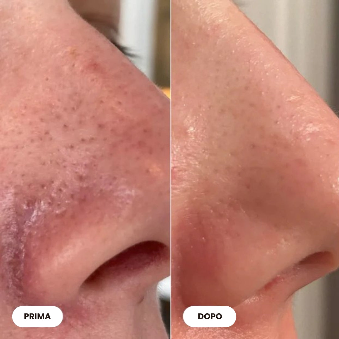 Peel Shot Glow™ | Peeling al siero di riso