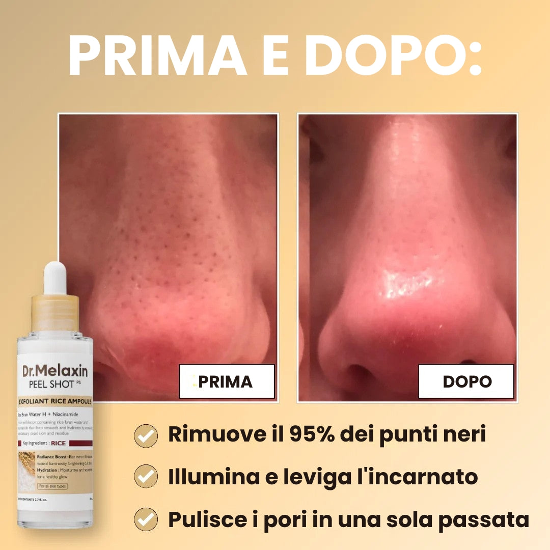 Peel Shot Glow™ | Peeling al siero di riso