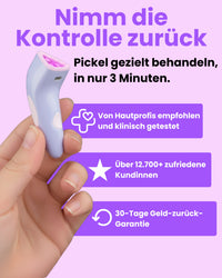 Luvely Spotfix™ | Gezielte Behandlung für unerwartete Pickel