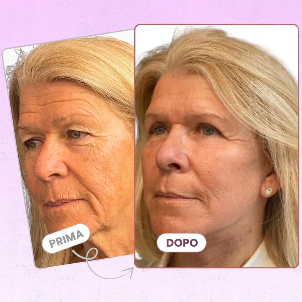 Luvely Trattamento Strutturale Ridensificante